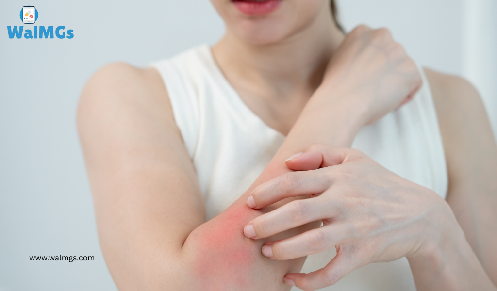 Skin Infections Antibiotics