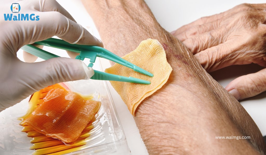 Antibiotics in Treating Wound Infections