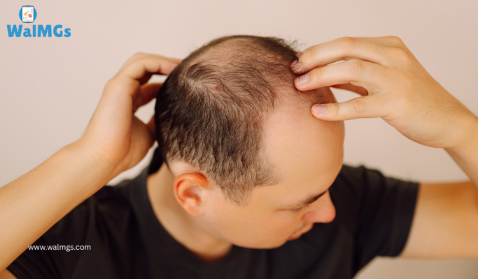 Regrow Confidence: Most Effective Hair Loss Treatment Pills