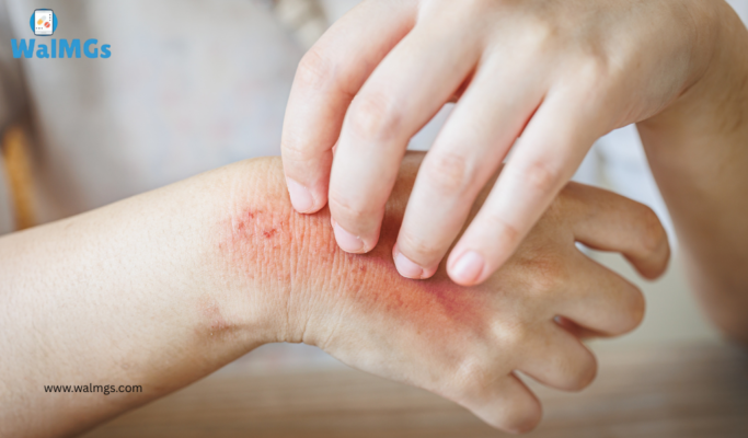 Skin Infections and Antibiotics: What You Need to Know